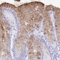 Gastrokine 2 Antibody, Novus Biologicals 0.1mL; Unlabeled:Antibodies, Polyclonal