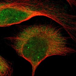 Gemin 3 Antibody, Novus Biologicals 0.1mL; Unlabeled:Antibodies, Polyclonal
