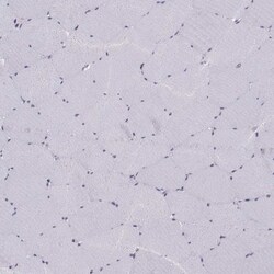 Gemin 3 Antibody, Novus Biologicals 0.1mL; Unlabeled:Antibodies, Polyclonal