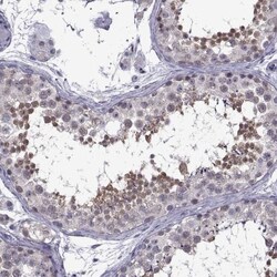 Gemin 3 Antibody, Novus Biologicals 0.1mL; Unlabeled:Antibodies, Polyclonal