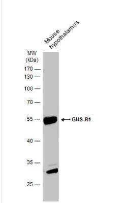 Ghrelin Receptor/GHSR Antibody, Novus Biologicals 0.1mL; Unlabeled:Antibodies,