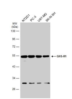 Ghrelin Receptor/GHSR Antibody, Novus Biologicals 0.1mL; Unlabeled:Antibodies,