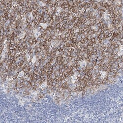 Girdin Antibody, Novus Biologicals 0.1mL; Unlabeled:Antibodies, Polyclonal