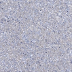 Girdin Antibody, Novus Biologicals 0.1mL; Unlabeled:Antibodies, Polyclonal