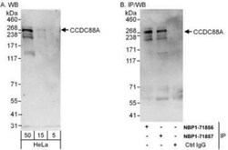 Girdin Antibody, Novus Biologicals 0.1mg; Unlabeled:Antibodies, Polyclonal