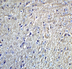 GluR5/GRIK1 Antibody - BSA Free, Novus Biologicals 0.1mg; Unlabeled:Antibodies,