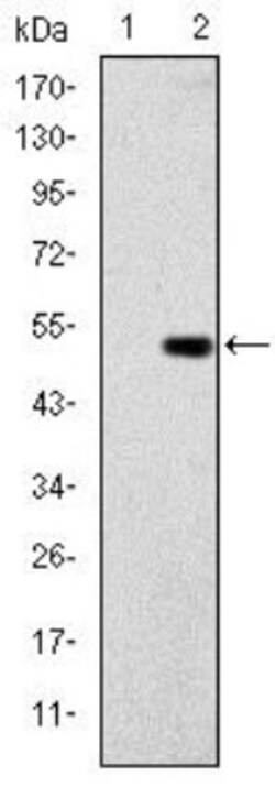 Glucokinase/GCK Antibody (4G6), Novus Biologicals 0.1mL; Unlabeled:Antibodies,