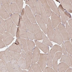 Glucosamine (N-acetyl)-6-Sulfatase/GNS Antibody, Novus Biologicals 0.1mL;