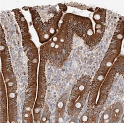 Glucosaminyl (N-acetyl) Transferase 1/GCNT1 Antibody, Novus Biologicals:Antibodies:Primary