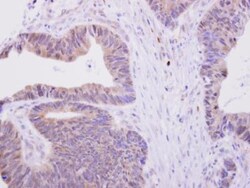 Glucose 1-dehydrogenase Antibody, Novus Biologicals 0.1mL; Unlabeled:Antibodies,