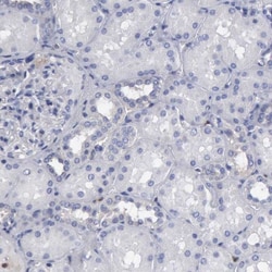 Glucose 6 Phosphate Dehydrogenase Antibody, Novus Biologicals 0.1mL; Unlabeled:Antibodies,