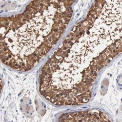 Glucose 6 Phosphate Dehydrogenase Antibody, Novus Biologicals 0.1mL; Unlabeled:Antibodies,