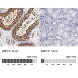 Glucose 6 Phosphate Dehydrogenase Antibody, Novus Biologicals 0.1mL; Unlabeled:Antibodies,