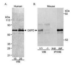 Glucose 6 Phosphate Dehydrogenase Antibody, Novus Biologicals&trade;