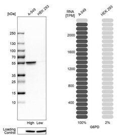 Glucose 6 Phosphate Dehydrogenase Antibody, Novus Biologicals 0.1mL; Unlabeled:Antibodies,