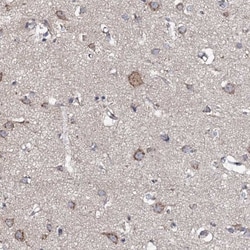 Glucuronic Acid Epimerase Antibody, Novus Biologicals 25 &mu;L, Unlabeled:Antibodies,