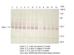 Glut1 Antibody, Novus Biologicals:Antibodies:Primary Antibodies