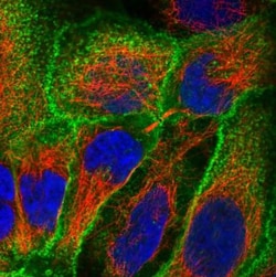 Glut3 Antibody, Novus Biologicals:Antibodies:Primary Antibodies