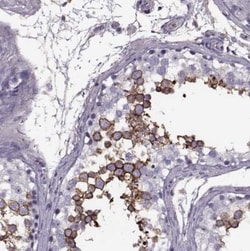Glut3 Antibody, Novus Biologicals:Antibodies:Primary Antibodies