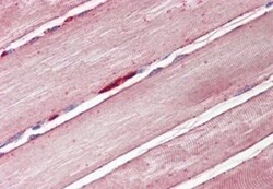 Glut4 Antibody, Novus Biologicals 0.1mg; Unlabeled:Antibodies, Polyclonal