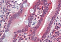 Glut5 Antibody, Novus Biologicals 0.1mg; Unlabeled:Antibodies, Polyclonal