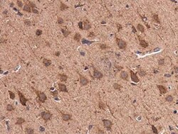 Glutamate Dehydrogenase Antibody, Novus Biologicals 0.1mL; Unlabeled:Antibodies,