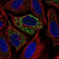 Glutaminase Antibody, Novus Biologicals 0.1mL; Unlabeled:Antibodies, Polyclonal
