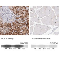 Glutaminase Antibody, Novus Biologicals 0.1mL; Unlabeled:Antibodies, Polyclonal