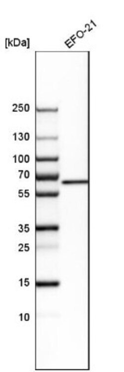 Glutaminase Antibody, Novus Biologicals 0.1mL; Unlabeled:Antibodies, Polyclonal