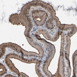 Glutathione Peroxidase 2/GPX2 Antibody, Novus Biologicals 25 &mu;L; Unlabeled:Antibodies,