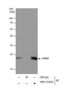 Glutathione Peroxidase 2/GPX2 Antibody, Novus Biologicals 0.1mg; Unlabeled:Antibodies,