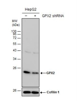 Glutathione Peroxidase 2/GPX2 Antibody, Novus Biologicals 0.1mg; Unlabeled:Antibodies,