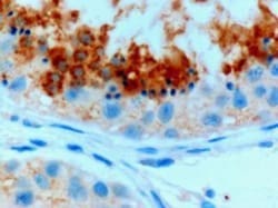Glutathione Peroxidase 4/GPX4 Antibody - Isoform a and c, Novus Biologicals