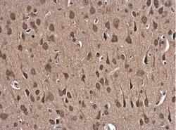 Glutathione Reductase Antibody, Novus Biologicals 0.1mL; Unlabeled:Antibodies,