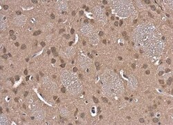 Glutathione Reductase Antibody, Novus Biologicals 0.1mL; Unlabeled:Antibodies,