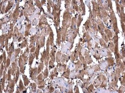 Glutathione S-Transferase mu 1/GSTM1 Antibody, Novus Biologicals 0.1mg;