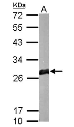 Glutathione S-Transferase mu 1/GSTM1 Antibody, Novus Biologicals 0.1mg;
