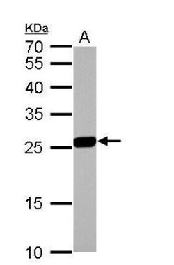 Glutathione S-Transferase mu 1/GSTM1 Antibody, Novus Biologicals 0.1mg;