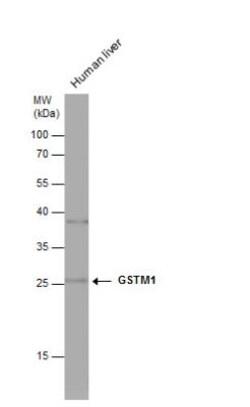 Glutathione S-Transferase mu 1/GSTM1 Antibody, Novus Biologicals 0.1mg;