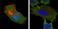 Glutathione S-Transferase pi 1/GSTP1 Antibody (3F2C2), Novus Biologicals