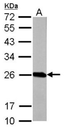 Glutathione S-Transferase pi 1/GSTP1 Antibody, Novus Biologicals 0.1mL;