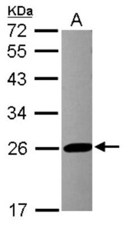 Glutathione S-Transferase pi 1/GSTP1 Antibody, Novus Biologicals 0.1mL;