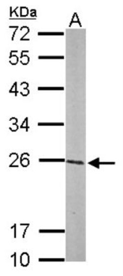 Glutathione S-Transferase pi 1/GSTP1 Antibody, Novus Biologicals 0.1mL;
