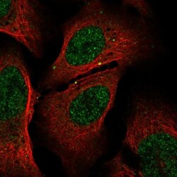 Glutathione Synthetase Antibody, Novus Biologicals 0.1mL; Unlabeled:Antibodies,