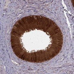 Glutathione Synthetase Antibody, Novus Biologicals 0.1mL; Unlabeled:Antibodies,