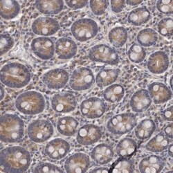 GlyBP Antibody, Novus Biologicals 25 &mu;L; Unlabeled:Antibodies, Polyclonal