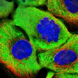 Glycine N-Methyltransferase/GNMT Antibody, Novus Biologicals 0.1mL; Unlabeled:Antibodies,