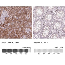 Glycine N-Methyltransferase/GNMT Antibody, Novus Biologicals 0.1mL; Unlabeled:Antibodies,