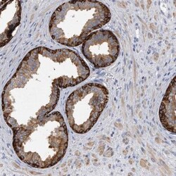 Glycogen Phosphorylase BB/GPBB Antibody, Novus Biologicals 0.1mL; Unlabeled:Antibodies,