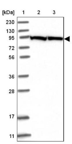 Glycogen Phosphorylase BB/GPBB Antibody, Novus Biologicals 0.1mL; Unlabeled:Antibodies,